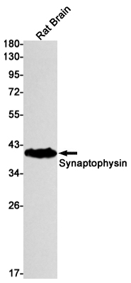Synaptophysin Rabbit mAb ABZ3181