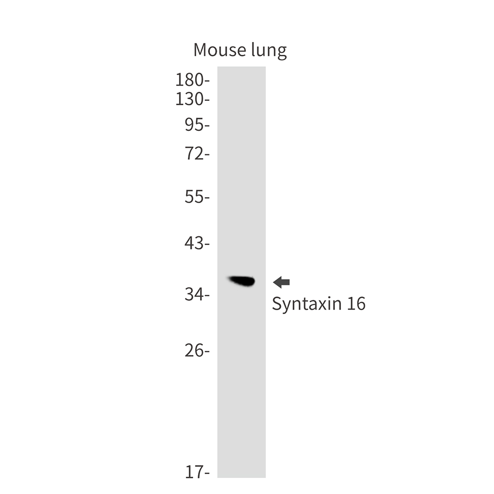 Syntaxin 16 Rabbit mAb ABZ3182