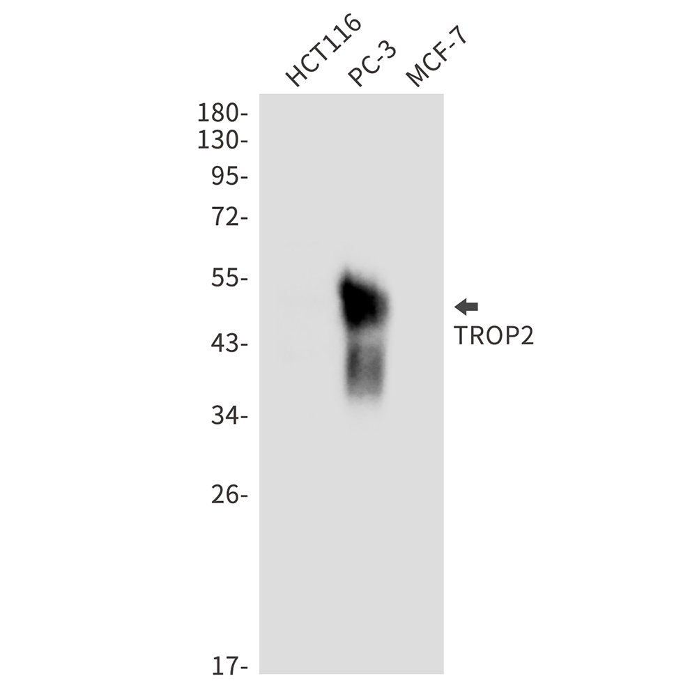 TROP2 Rabbit mAb ABZ3183