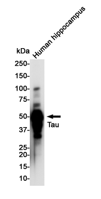 Tau Rabbit mAb ABZ3186