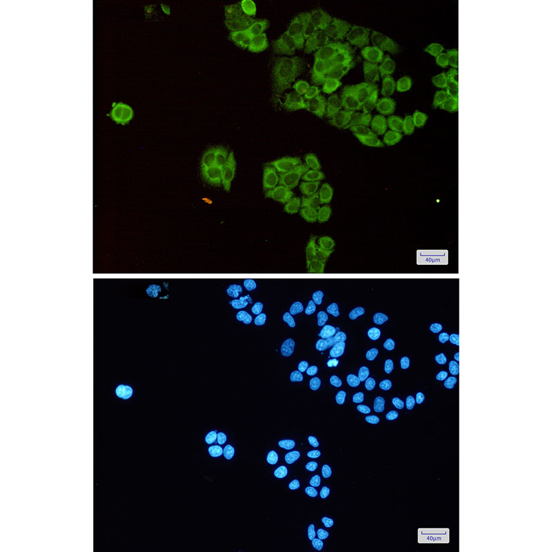 TCTP Rabbit mAb ABZ3191
