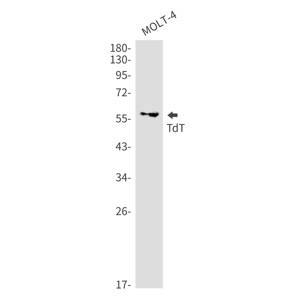 TdT Rabbit mAb ABZ3192