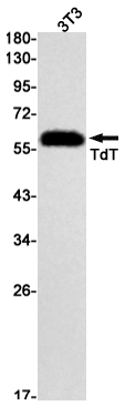 TdT Rabbit mAb ABZ3192