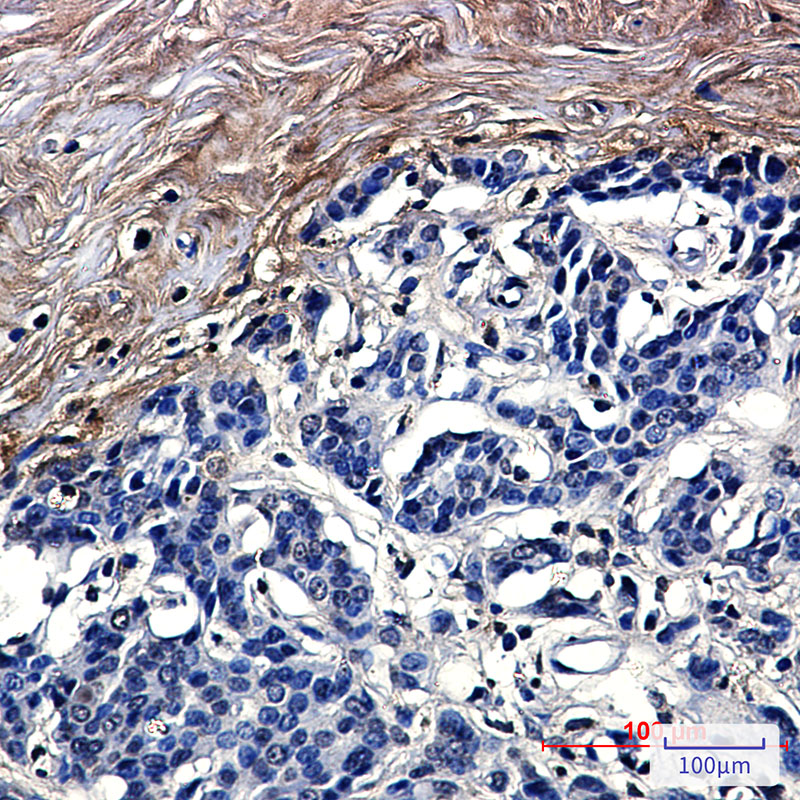 Tetranectin Rabbit mAb ABZ3193