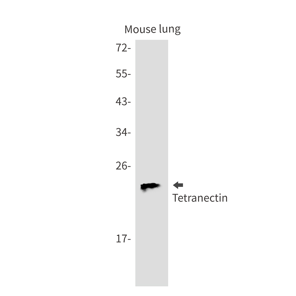 Tetranectin Rabbit mAb ABZ3193