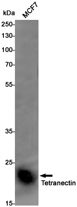 Tetranectin Rabbit mAb ABZ3193