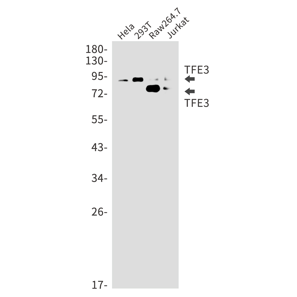 TFE3 Rabbit mAb ABZ3194