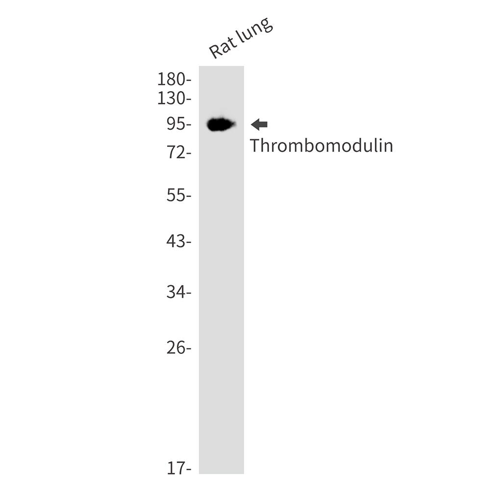 Thrombomodulin Rabbit mAb ABZ3195