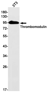 Thrombomodulin Rabbit mAb ABZ3195