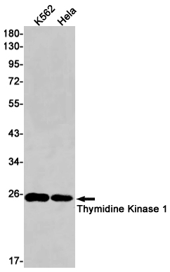 TK1 Rabbit mAb ABZ3196