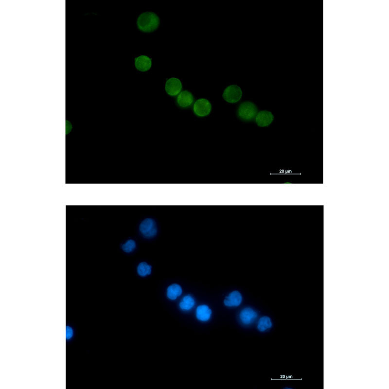 Thymidylate Synthase Rabbit mAb ABZ3197
