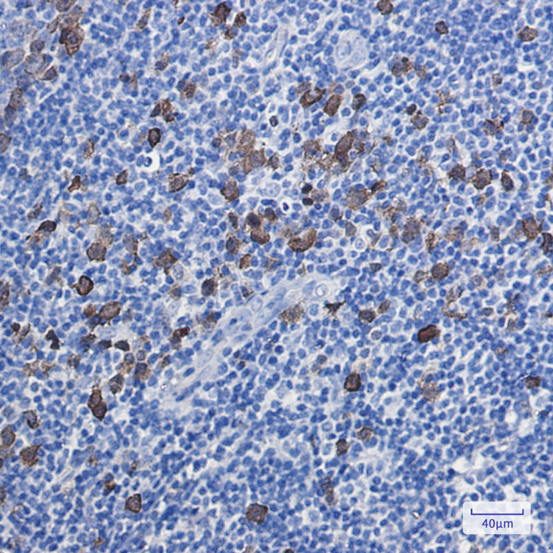 Thymidylate Synthase Rabbit mAb ABZ3197