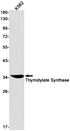 Thymidylate Synthase Rabbit mAb ABZ3197