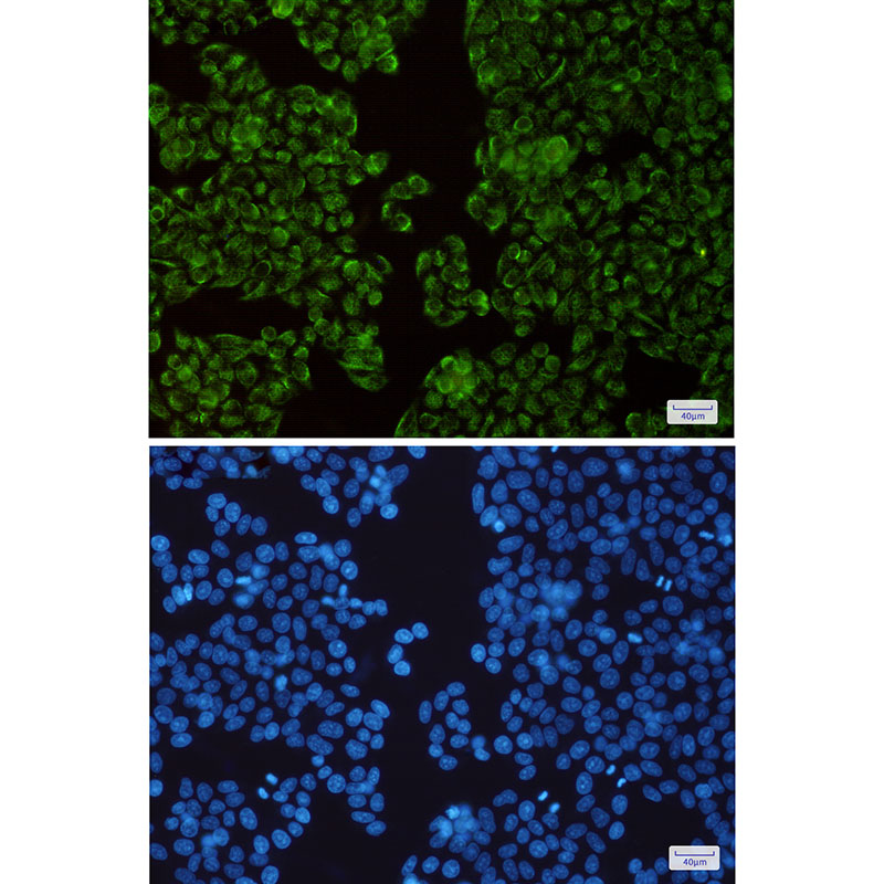 TIMM44 Rabbit mAb ABZ3199