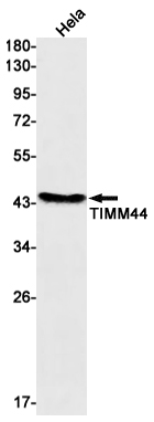 TIMM44 Rabbit mAb ABZ3199