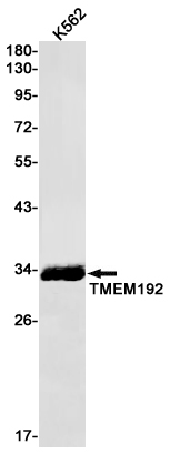 TMEM192 Rabbit mAb ABZ3200