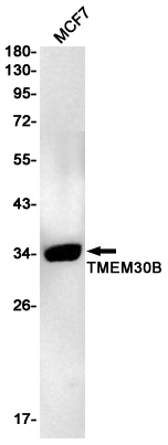 Transmembrane Protein 30B Rabbit mAb ABZ3201