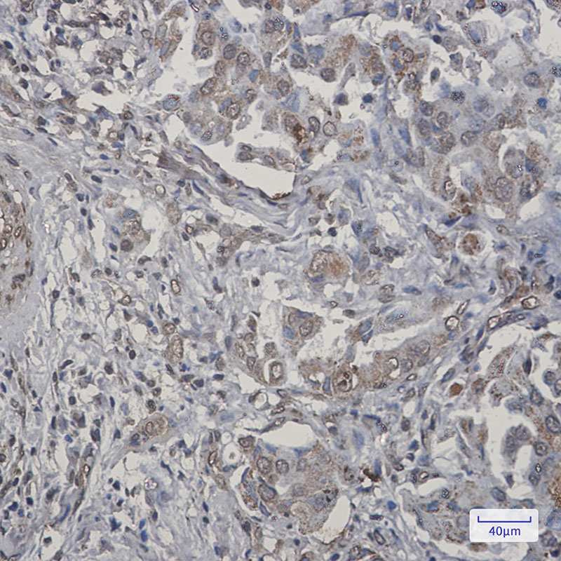 TNFAIP3 Rabbit mAb ABZ3202