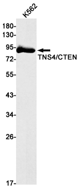 Tensin 4 Rabbit mAb ABZ3203