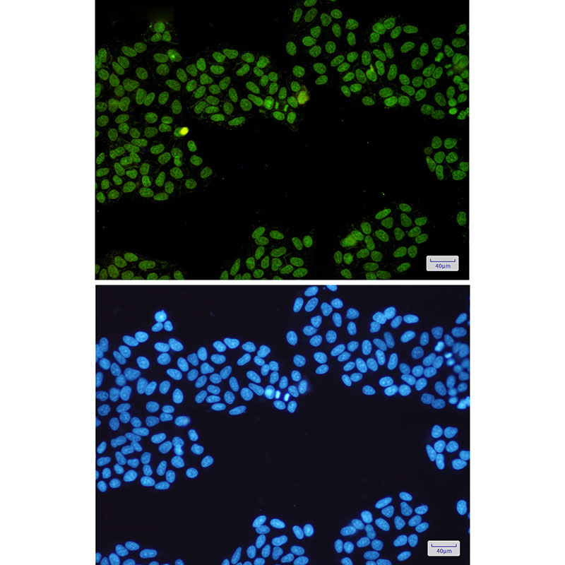 Topoisomerase I Rabbit mAb ABZ3204