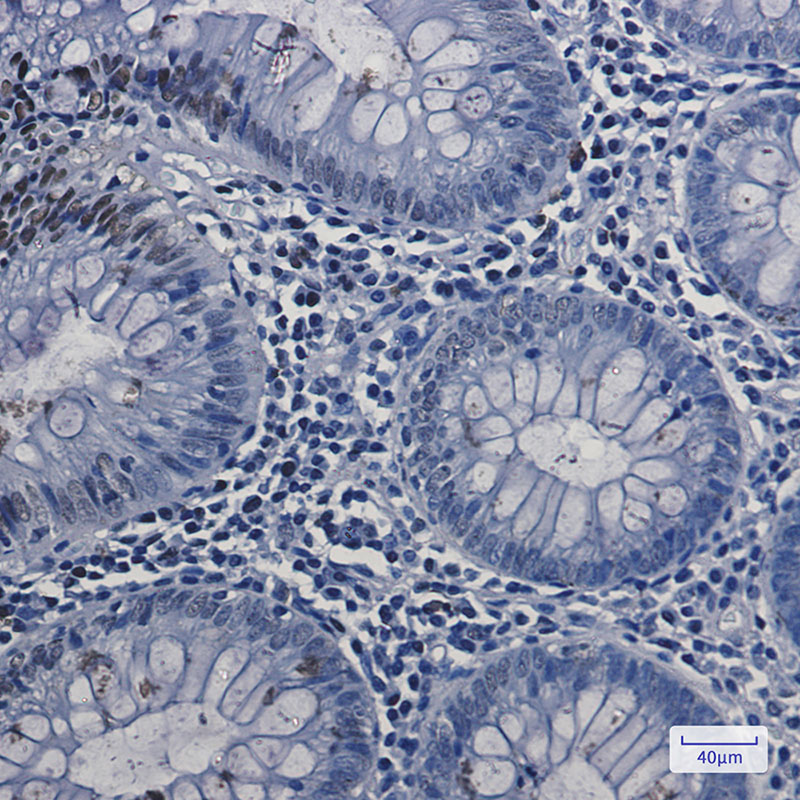Topoisomerase I Rabbit mAb ABZ3204
