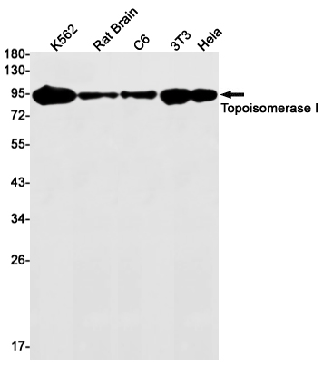 Topoisomerase I Rabbit mAb ABZ3204