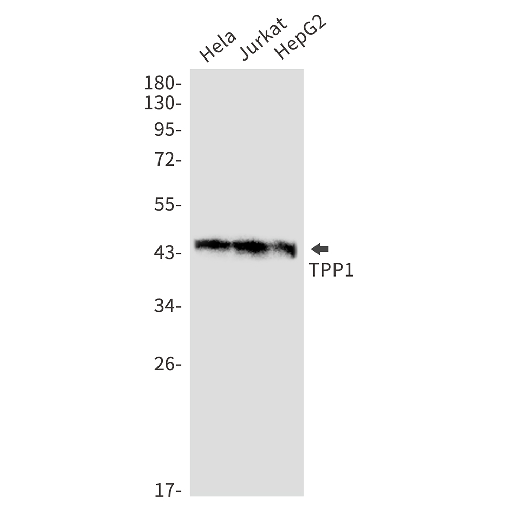 TPP1 Rabbit mAb ABZ3205