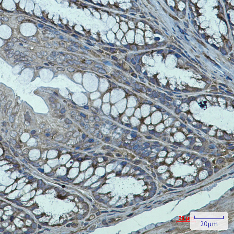 Transglutaminase 2 Rabbit mAb ABZ3206