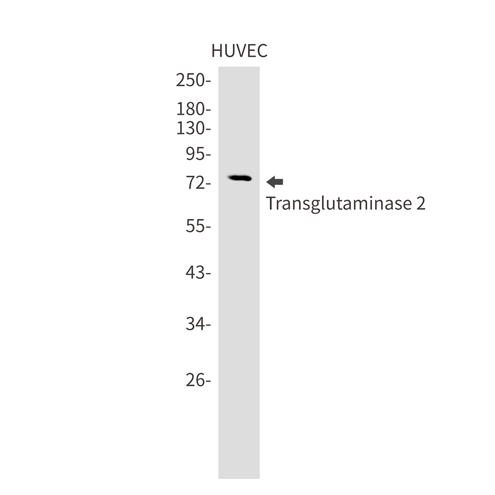 Transglutaminase 2 Rabbit mAb ABZ3206