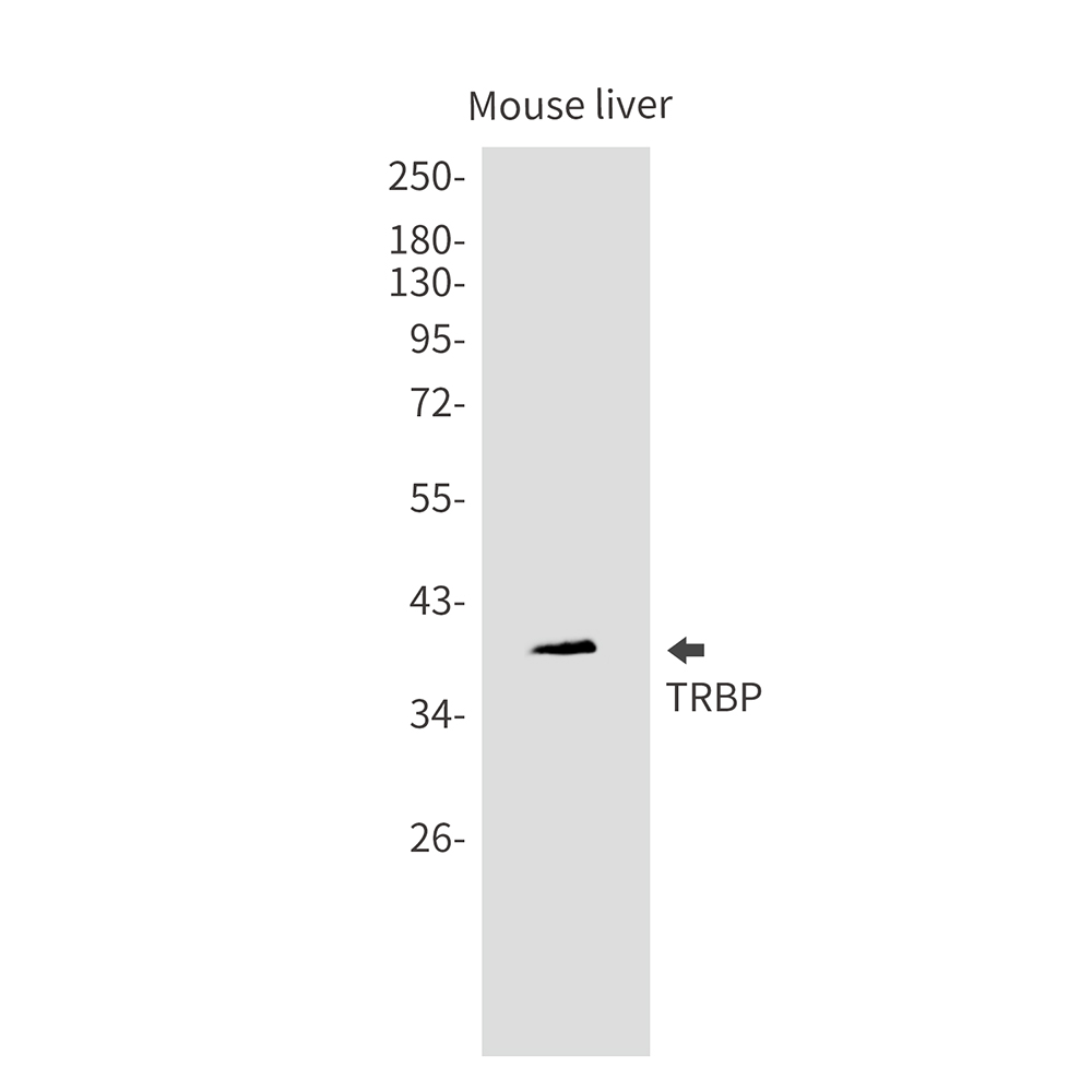 TARBP2 Rabbit mAb ABZ3208
