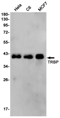 TARBP2 Rabbit mAb ABZ3208