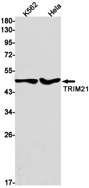 TRIM21 Rabbit mAb ABZ3209