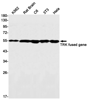 TFG Rabbit mAb ABZ3211