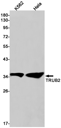 TRUB2 Rabbit mAb ABZ3212