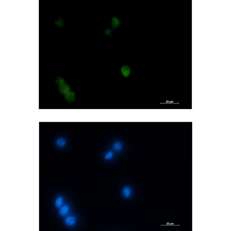 Thyroid Transcription Factor 1 Rabbit mAb ABZ3213