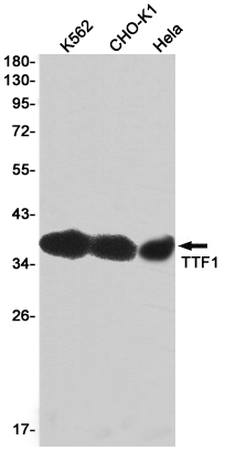 Thyroid Transcription Factor 1 Rabbit mAb ABZ3213