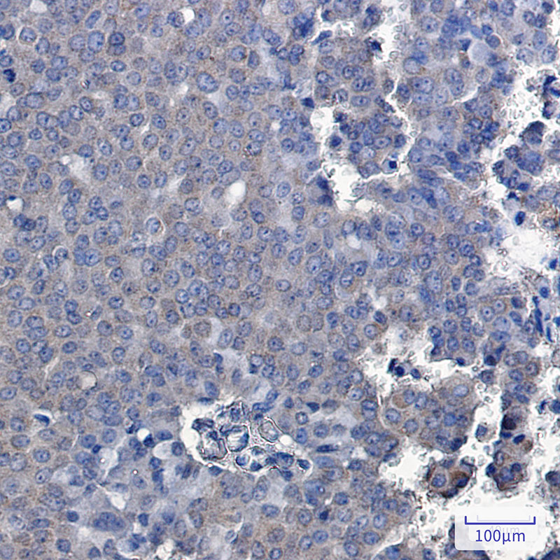 TXNDC9 Rabbit mAb ABZ3214