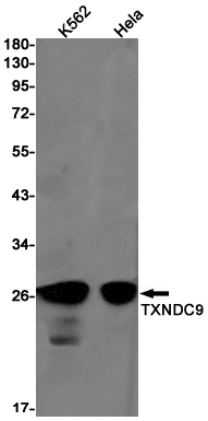 TXNDC9 Rabbit mAb ABZ3214