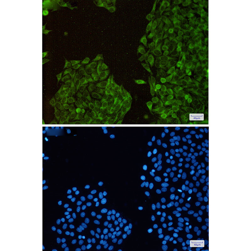 TXNL1 Rabbit mAb ABZ3215