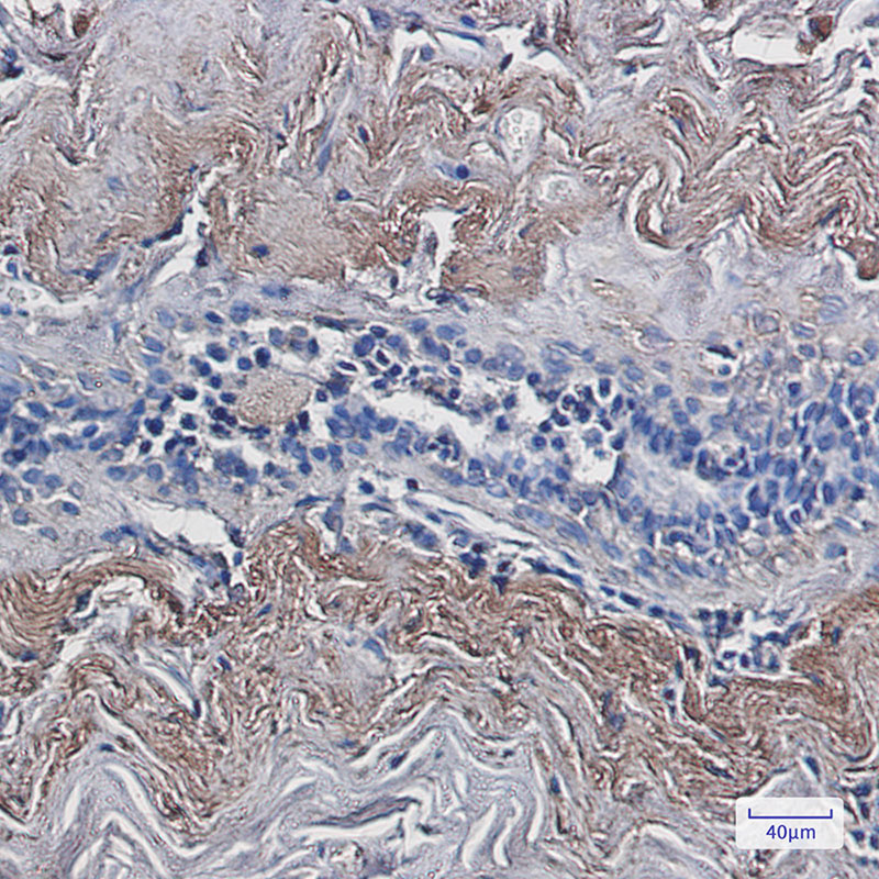 TXNL1 Rabbit mAb ABZ3215