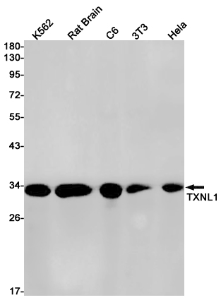 TXNL1 Rabbit mAb ABZ3215