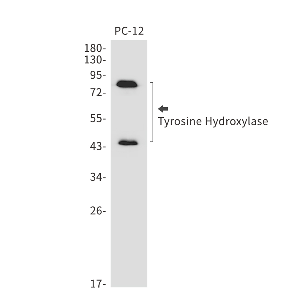 Tyrosine Hydroxylase Rabbit mAb ABZ3216