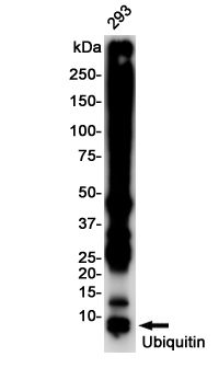 Ubiquitin Rabbit mAb ABZ3218