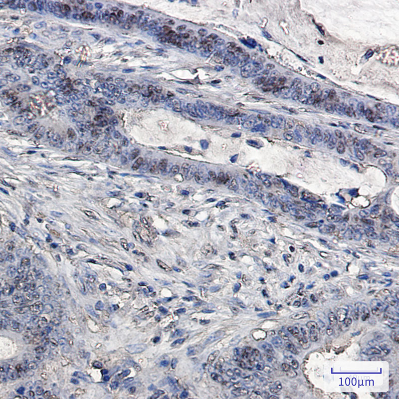 Ubiquitin Rabbit mAb ABZ3219