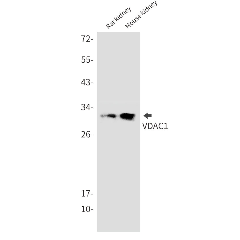 VDAC1/Porin Rabbit mAb ABZ3223