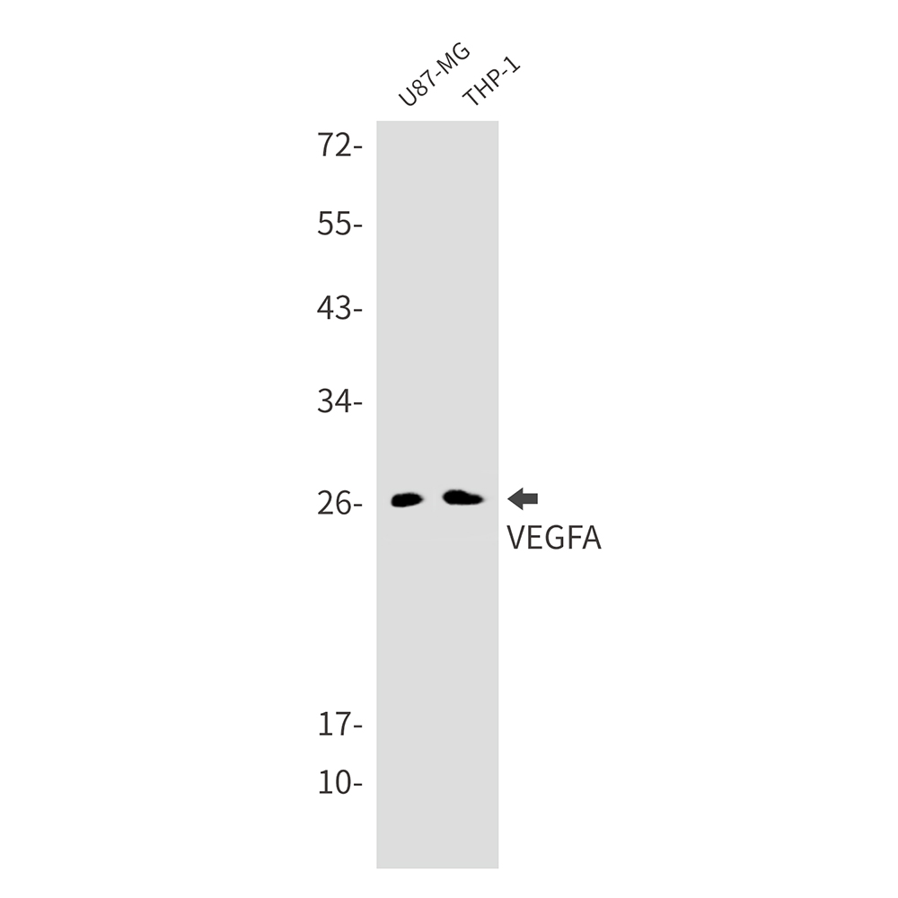 VEGFA Rabbit mAb ABZ3224
