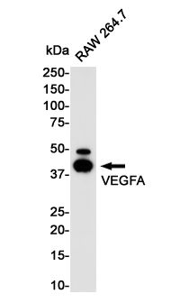 VEGFA Rabbit mAb ABZ3224