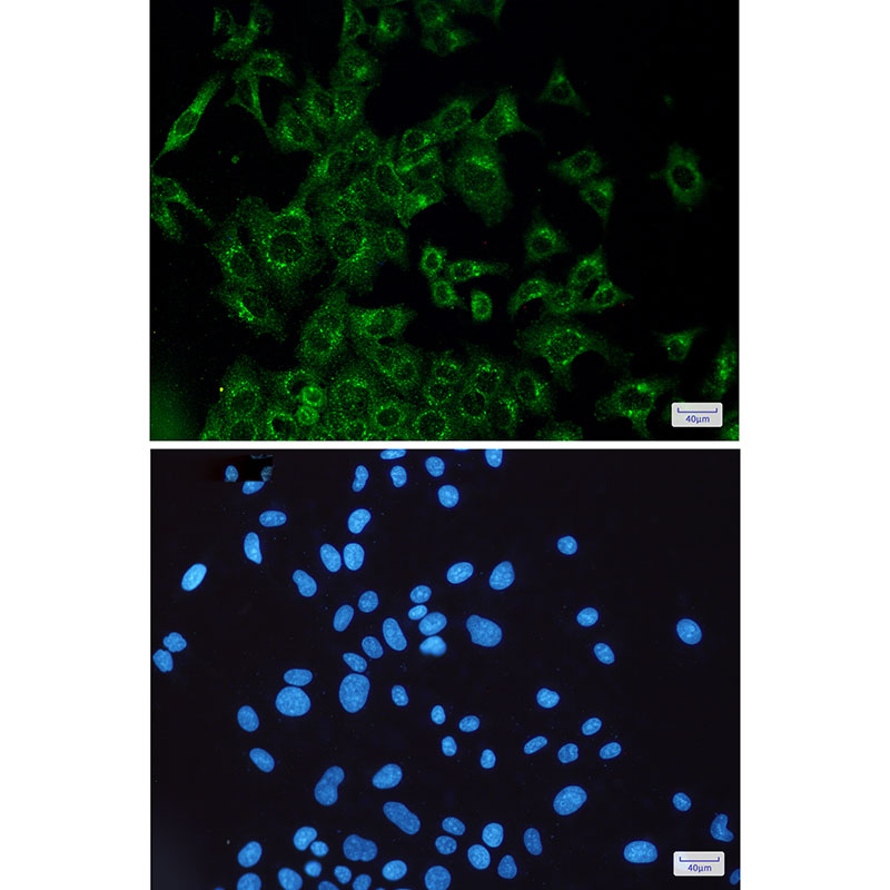 VEGFD Rabbit mAb ABZ3225
