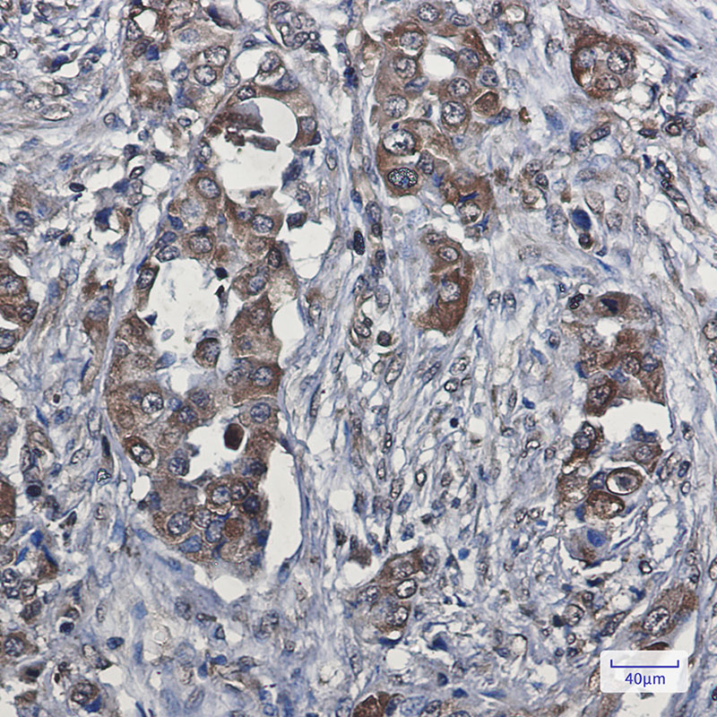 VEGFD Rabbit mAb ABZ3225