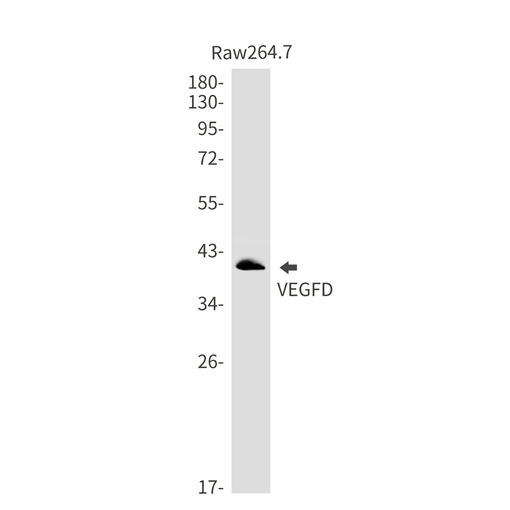 VEGFD Rabbit mAb ABZ3225